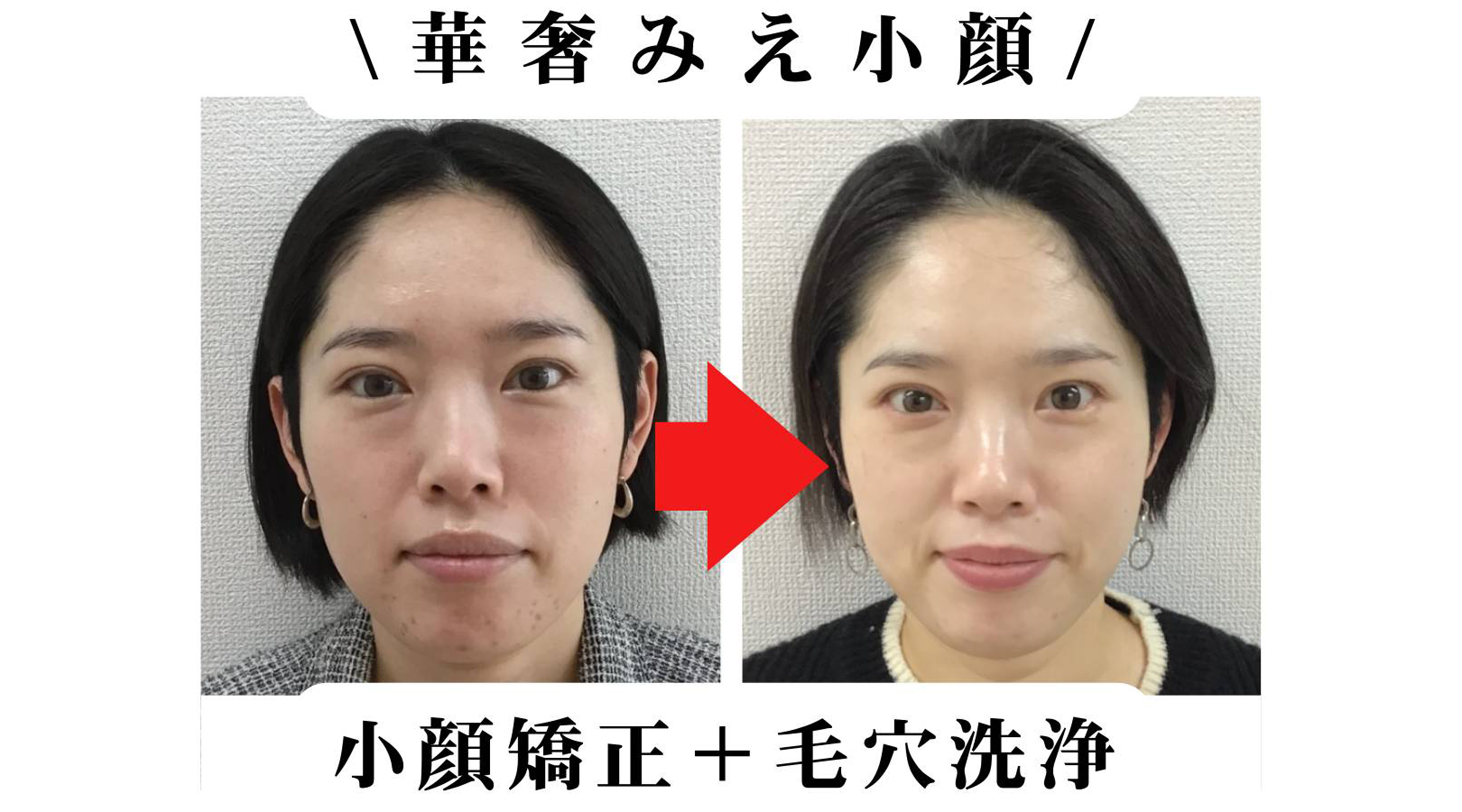 BUPURA浜松上島店のサブ写真１